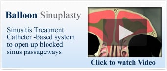 1760561999_btn-balloon-sinuplasty Services